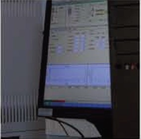 Gas Chromatography Mass Spectrometry